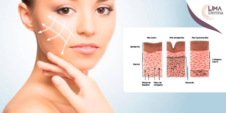 Como estimular el colágeno en la piel