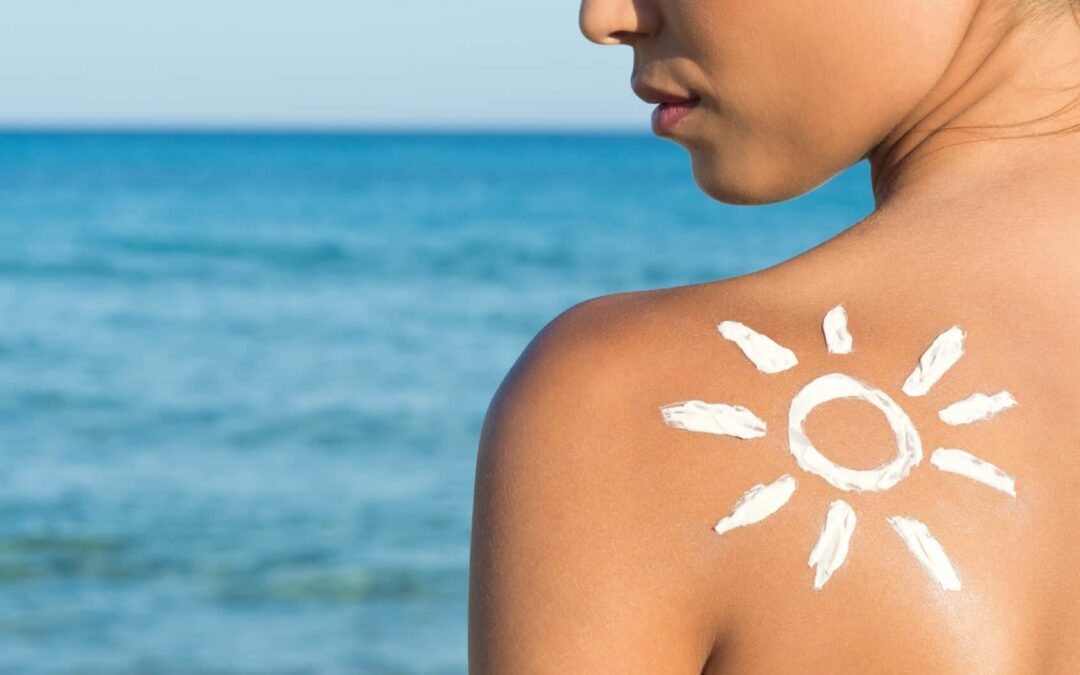 ¿Cómo prevenir el cáncer de piel este verano?
