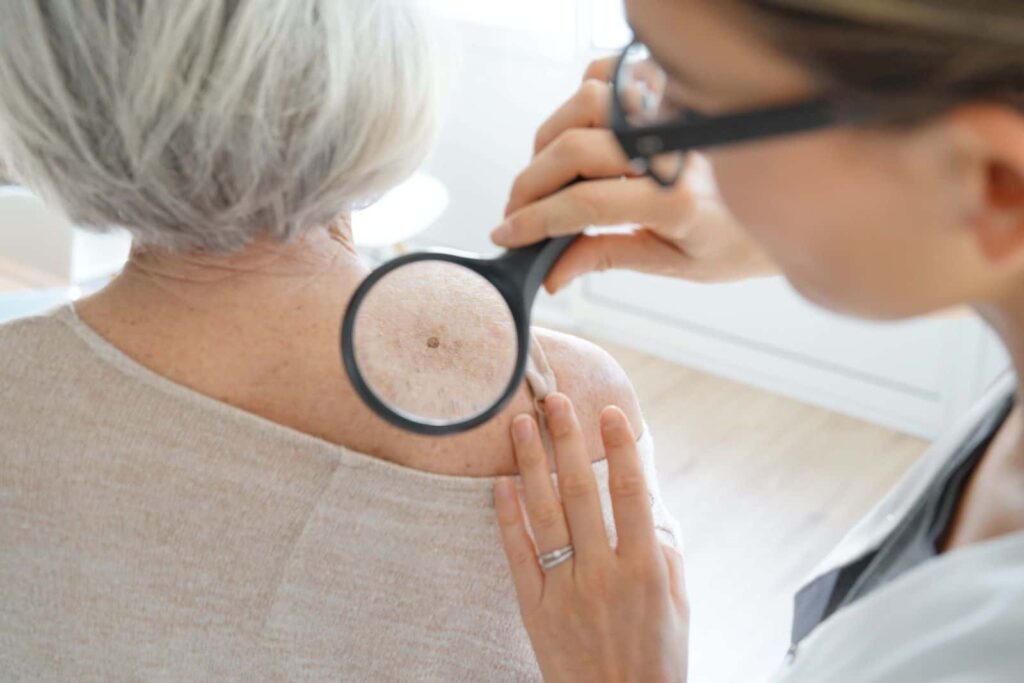 prevención de cancer de piel