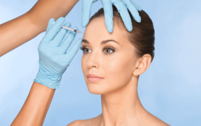 Botox: 5 puntos para saber si es el tratamiento ideal para ti